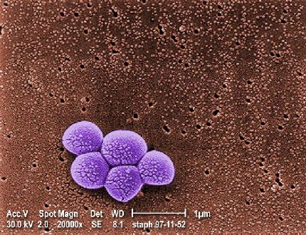 Представитель Семейства Eubacteriaceae